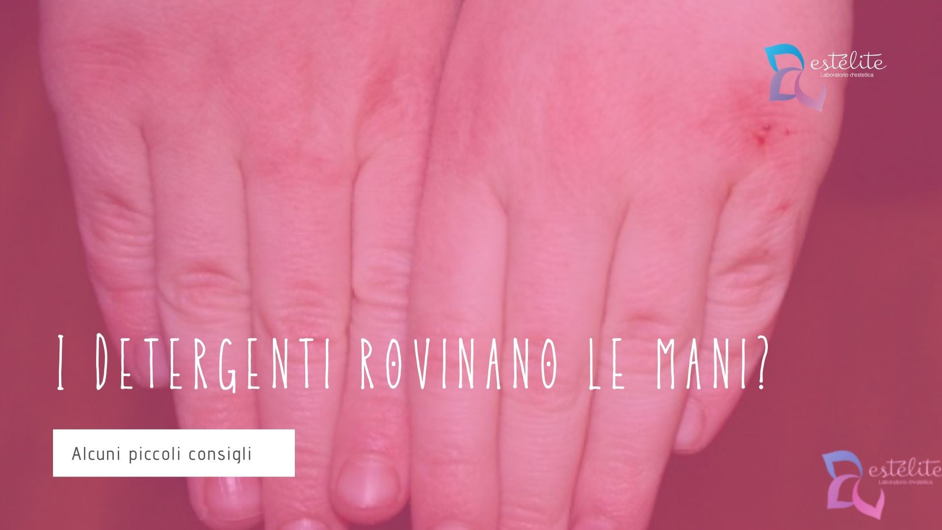 detergenti rovinano mani