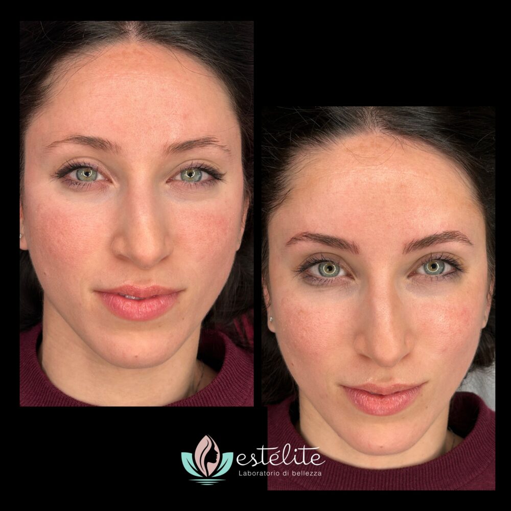 microblading prima dopo